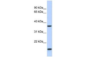 Western Blotting (WB) image for anti-Zic Family Member 4 (ZIC4) antibody (ABIN2458430) (ZIC4 抗体)