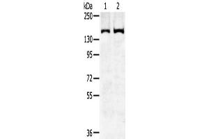 Gel: 6 % SDS-PAGE,Lysate: 40 μg,Lane 1-2: Hela cells, K562 cells,Primary antibody: ABIN7192310(SENP6 Antibody) at dilution 1/450 dilution,Secondary antibody: Goat anti rabbit IgG at 1/8000 dilution,Exposure time: 5 minutes (SENP6 抗体)