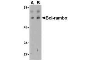 Western blot analysis of Bcl-rambo in K562 cell lysate with AP30131PU-N Bcl-rambo antibody at (A) 2 and (B) 4 μg/ml. (BCL2L13 抗体  (Intermediate Domain))