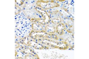 Immunohistochemistry (IHC) image for anti-Opioid Growth Factor Receptor (OGFR) (AA 1-280) antibody (ABIN6145006)