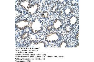 Rabbit Anti-RAD23A Antibody  Paraffin Embedded Tissue: Human Lung Cellular Data: Alveolar cells Antibody Concentration: 4. (RAD23A 抗体  (N-Term))