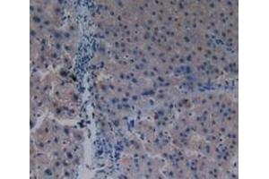 Detection of PAK1 in Human Liver Tissue using Polyclonal Antibody to p21 Protein Activated Kinase 1 (PAK1) (PAK1 抗体  (AA 252-501))