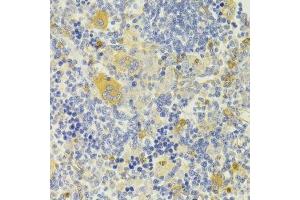 Immunohistochemistry of paraffin-embedded rat spleen using DPP3 Antibody. (DPP3 抗体  (AA 1-280))