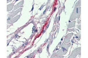 DDAH2 antibody was used for immunohistochemistry at a concentration of 4-8 ug/ml. (DDAH2 抗体  (N-Term))