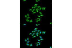 Immunofluorescence analysis of A-549 cells using CPT1A antibody. (CPT1A 抗体  (AA 497-756))