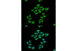 Immunofluorescence analysis of A-549 cells using CPT1A antibody.
