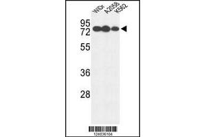 Western blot analysis of GUSB Antibody in WiDr, A2058, K562 cell line lysates (35ug/lane) (Glucuronidase beta 抗体  (AA 335-362))
