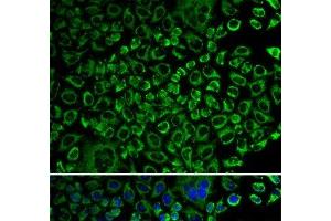 Immunofluorescence analysis of A549 cells using F10 Polyclonal Antibody (Coagulation Factor X 抗体)