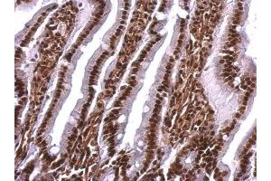 Immunohistochemistry (IHC) image for anti-Scaffold Attachment Factor B (SAFB) antibody (ABIN2855048)
