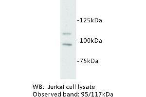 Image no. 1 for anti-Mast/stem Cell Growth Factor Receptor (KIT) antibody (ABIN1112872) (KIT 抗体)