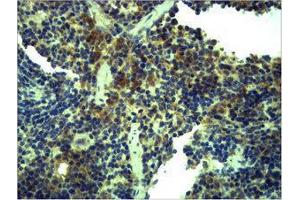 Immunohistochemistry (IHC) image for anti-Toll-Like Receptor 1 (TLR1) antibody (ABIN3181539) (TLR1 抗体)