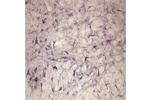 IHC on rat spinal cord using Rabbit antibody to extracellular, N-terminal part of Sortilin (Neurotensin receptor 3, NTR3, Sort1): IgG  at a concentration of 10 µg/ml. (Sortilin 1 抗体)