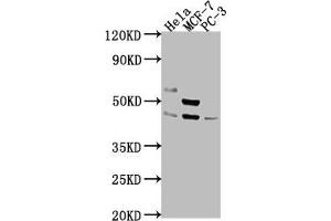 Western Blot Positive WB detected in: Hela whole cell lysate, MCF-7 whole cell lysate, PC-3 whole cell lysate All lanes: POU4F1 antibody at 1:2000 Secondary Goat polyclonal to rabbit IgG at 1/50000 dilution Predicted band size: 43, 34 kDa Observed band size: 43 kDa