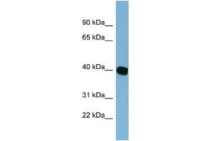 WB Suggested Anti-C14orf148 Antibody Titration: 0. (NOXRED1 抗体  (Middle Region))