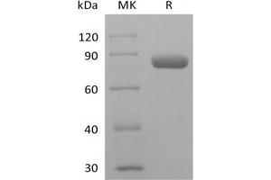 Western Blotting (WB) image for Nectin-2 (NECTIN2) protein (Fc Tag) (ABIN7319926) (Nectin-2 Protein (NECTIN2) (Fc Tag))