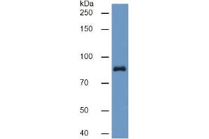 Western Blotting (WB) image for Plasminogen (PLG) ELISA Kit (ABIN6574264)