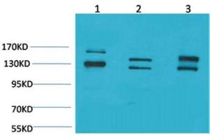 Western Blot (WB) analysis of 1) 293T, 2) Mouse Brain Tissue, 3) Rat Brain Tissue with BAI1 Rabbit Polyclonal Antibody diluted at 1:2000. (BAI1 抗体)