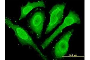 Image no. 2 for anti-Cytoglobin (CYGB) (AA 1-191) antibody (ABIN466266) (CYGB 抗体  (AA 1-191))