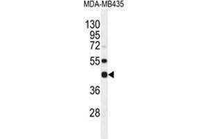 WDR51B Antibody (C-term) western blot analysis in MDA-MB435 cell line lysates (35 µg/lane). (POC1B 抗体  (C-Term))