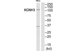 Western Blotting (WB) image for anti-Potassium Voltage-Gated Channel, Subfamily H (Eag-Related), Member 3 (Kcnh3) (Internal Region) antibody (ABIN1851848) (KCNH3 抗体  (Internal Region))