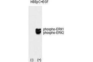 Western blot analysis of phospho-ERK1/2 antibody and HBEpC cell lysate, noninduced (lane 1) or induced with the EGF (lane 2). (ERK1/2 抗体  (pThr202, pTyr204))