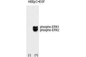 Western blot analysis of phospho-ERK1/2 antibody and HBEpC cell lysate, noninduced (lane 1) or induced with the EGF (lane 2).