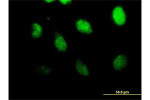 Immunofluorescence of purified MaxPab antibody to CSPG6 on HeLa cell. (SMC3 抗体  (AA 1-1217))