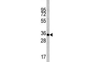 Western Blotting (WB) image for anti-Caspase 6, Apoptosis-Related Cysteine Peptidase (CASP6) (AA 235-263) antibody (ABIN3030311)