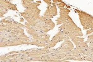 Immunohistochemistry analysis of paraffin-embedded mouse heart using,RHOBTB3 (ABIN7075422) at dilution of 1: 3600 (RHOBTB3 抗体)