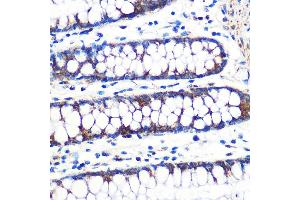 Immunohistochemistry of paraffin-embedded human colon using TFAM Rabbit mAb (ABIN3023684, ABIN3023685, ABIN3023686, ABIN1680049 and ABIN1680050) at dilution of 1:100 (40x lens). (TFAM 抗体)