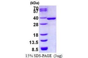 NmrA-Like Family Domain Containing 1 (NMRAL1) protein (His tag)