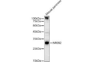 Western blot analysis of extracts of Mouse pancreas, using NR0B2 antibody (ABIN3015600, ABIN3015601, ABIN3015602, ABIN1681099 and ABIN6218962) at 1:500 dilution.