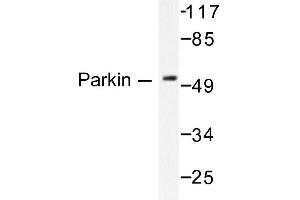 Image no. 1 for anti-Parkinson Protein 2, E3 Ubiquitin Protein Ligase (Parkin) (PARK2) antibody (ABIN271775) (Parkin 抗体)