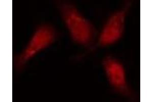 ABIN6276417 staining  HeLa cells by IF/ICC. (JUP 抗体  (C-Term))
