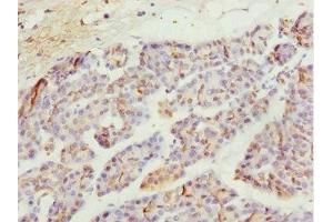 Immunohistochemistry of paraffin-embedded human pancreatic tissue using ABIN7174959 at dilution of 1:100 (MYO5C 抗体  (AA 270-420))