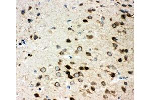 IHC-P: Integrin alpha 3 antibody testing of rat brain tissue (ITGA3 抗体  (N-Term))