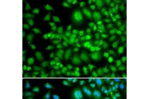 Immunofluorescence analysis of MCF-7 cells using SETD5 Polyclonal Antibody (SETD5 抗体)