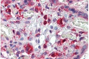 Human Placenta: Formalin-Fixed, Paraffin-Embedded (FFPE) (AAK1 抗体  (N-Term))