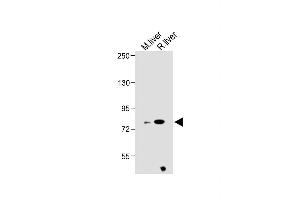 All lanes : Anti-ZBT24 Antibody (N-term) at 1:1000 dilution Lane 1: Mouse liver lysate Lane 2: Rat liver lysate Lysates/proteins at 20 μg per lane. (ZBTB24 抗体  (N-Term))