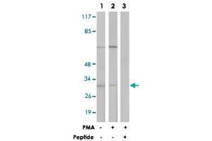 Western blot analysis of extracts from LoVo cells (Lane 1) and Jurkat cells (Lane 2 and 3) treated with PMA (125 ng/mL, 30 min), using MARCKS polyclonal antibody . (MARCKS 抗体  (Ser162.))