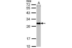WB Image Sample (30 ug of whole cell lysate) A: NIH-3T3 12% SDS PAGE VAPA antibody antibody diluted at 1:1000 (VAPA 抗体)