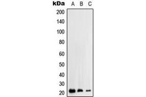Western blot analysis of RhoH expression in HEK293T (A), HepG2 (B), Jurkat (C) whole cell lysates. (RHOH 抗体  (C-Term))