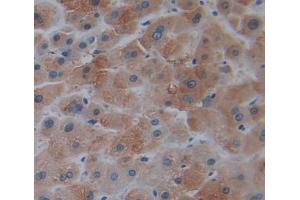 Used in DAB staining on fromalin fixed paraffin- embedded liver tissue (TRO 抗体  (AA 444-642))