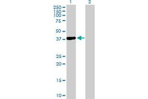 Western Blot analysis of NKX2-5 expression in transfected 293T cell line by NKX2-5 MaxPab polyclonal antibody. (NK2 Homeobox 5 抗体  (AA 1-324))