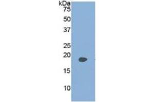 SDS-PAGE (SDS) image for Phospholipase A2-Activating Protein (PLAA) ELISA Kit (ABIN6730908)