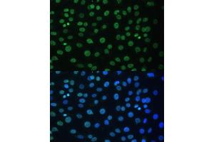 Immunofluorescence analysis of C6 cells using HNRNPD antibody (ABIN7267632) at dilution of 1:100. (HNRNPD/AUF1 抗体  (AA 1-306))