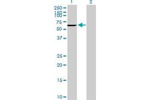 Western Blot analysis of CES2 expression in transfected 293T cell line by CES2 MaxPab polyclonal antibody. (CES2 抗体  (AA 1-623))