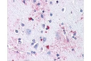 Immunohistochemical staining of Brain Cortex using AP31144PU-N SLC29A1 antibody (SLC29A1 抗体  (Internal Region))