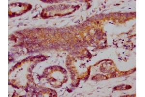 Immunohistochemistry (IHC) image for anti-CD274 (PD-L1) (AA 19-238) antibody (ABIN7164674)