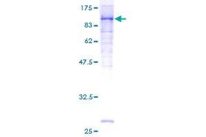 Image no. 1 for Melanoma Cell Adhesion Molecule (MCAM) (AA 1-646) protein (GST tag) (ABIN1310514) (MCAM Protein (AA 1-646) (GST tag))